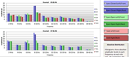 TQ Assessment histograms page