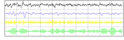 EEG brain waves