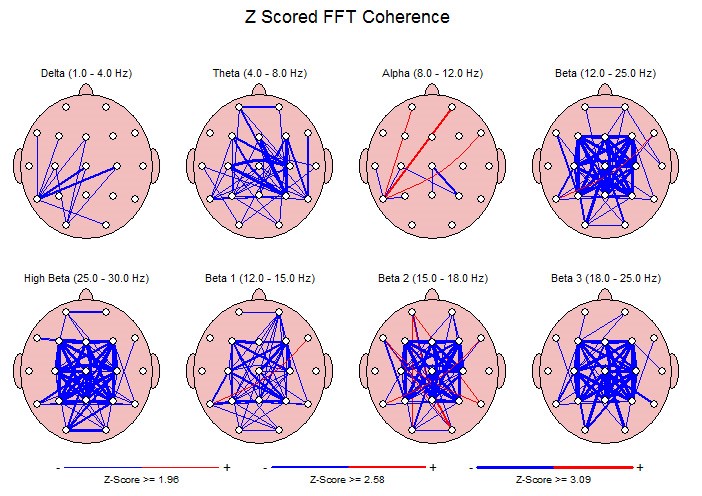 NeuroGuide coherence comparison