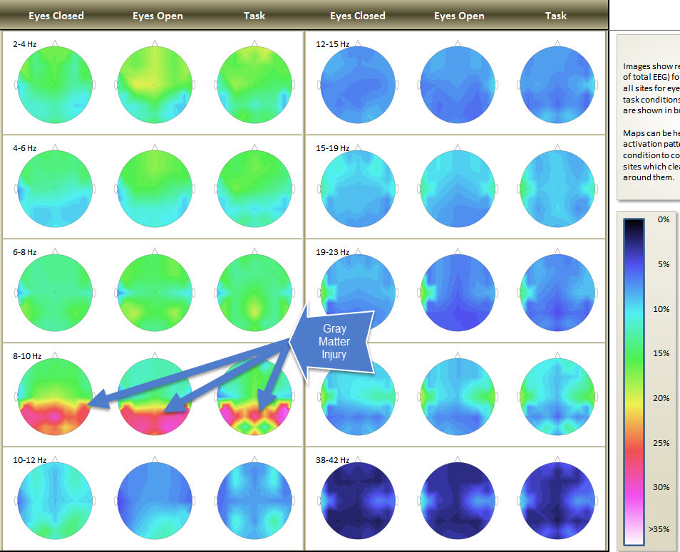 Trainer's Q Brain Pattern Findings